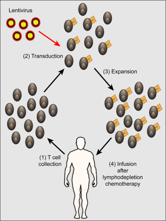 T-car cells gemoduleerd voor lymfklierkanker schema